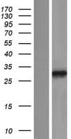PPAPDC3 Protein (Over-Expression Lysate Myc-DDK (Flag))