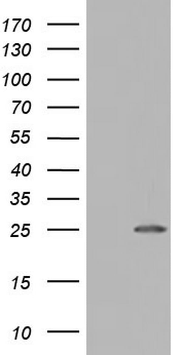 NUDT10 Antibody (clone OTI1A3)