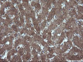 MMACHC Antibody (clone OTI1A4)