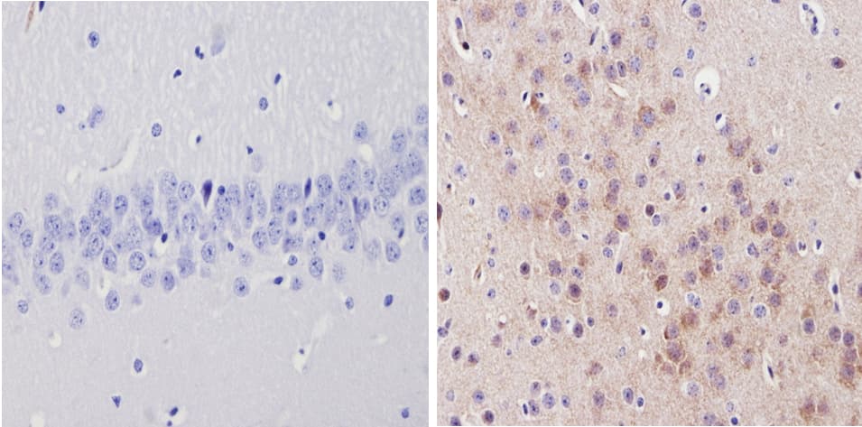 ADRA1A Antibody (3rd intracellular loop)
