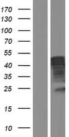 PAI-RBP1 / SERBP1 Protein (Over-Expression Lysate Myc-DDK (Flag))