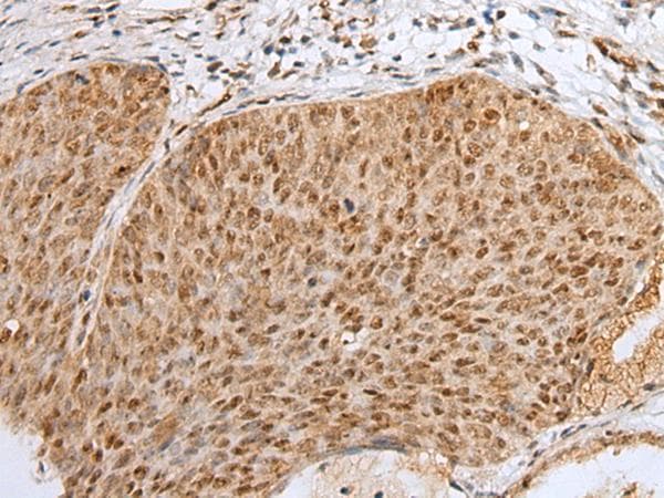 ZNF354A Antibody