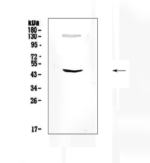 Polyclonal Rabbit anti-Human SOX4 Antibody (aa1-31, WB)