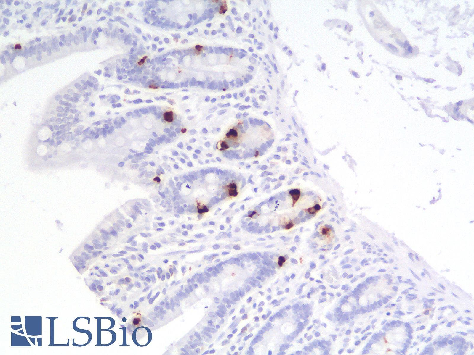 PathPlus™ Recombinant Monoclonal Rabbit anti-Human CHGA / Chromogranin A Antibody (clone CHGA/1815R, IHC)
