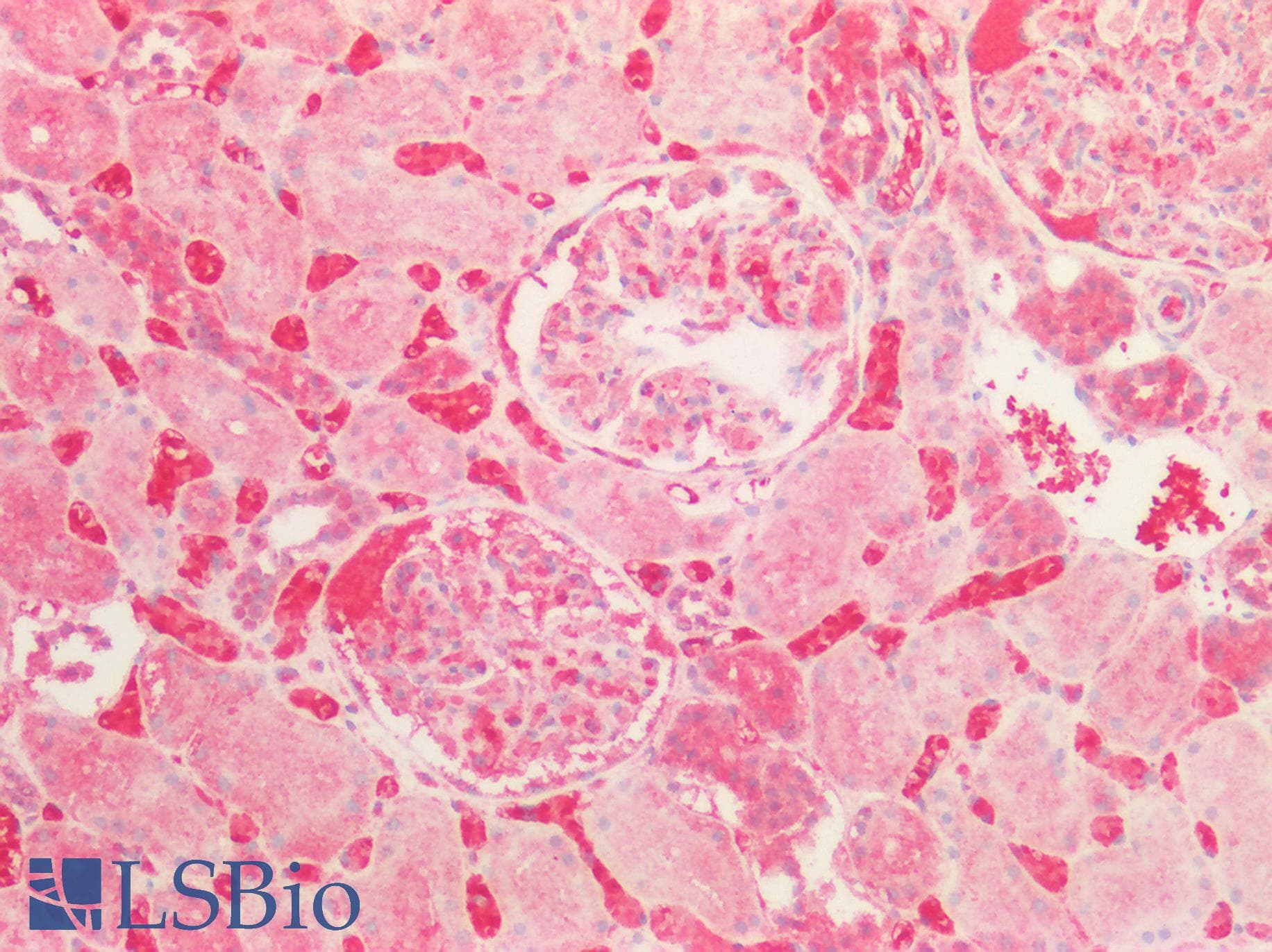IHC-plus™ Polyclonal Rabbit anti-Human FGF9 Antibody (IHC, IF, WB)