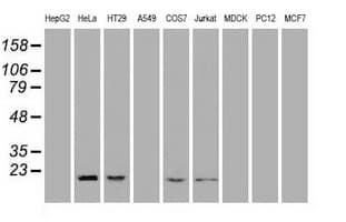 Monoclonal Mouse anti-Human AK1 / Adenylate Kinase 1 Antibody (clone OTI4A1, IF, WB)