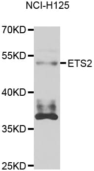 ETS2 Antibody