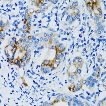 MMP7 / Matrilysin Antibody