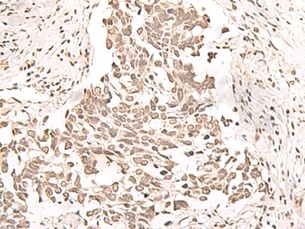 RRP1 Antibody