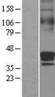 Human SLC30A3 / ZNT3 Protein (Over-Expression Lysate Myc-DDK (Flag))