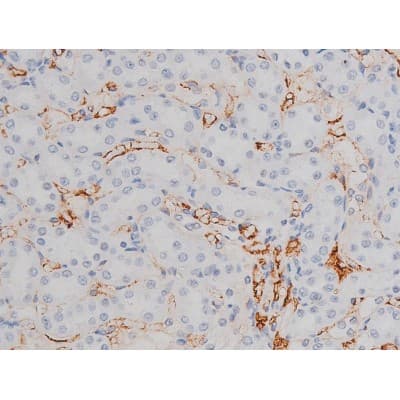 Polyclonal Rabbit anti-Human MAPT / Tau Antibody (phospho-Thr205, IHC, WB)