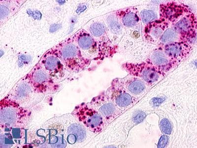 PathPlus™ GPRC5D Antibody (N-Terminus)