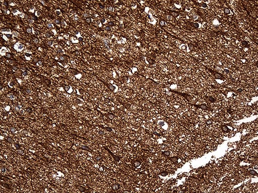 Monoclonal Mouse anti-Human DBN1 / Drebrin Antibody (clone OTI4B1, aa2-240, IHC, WB)