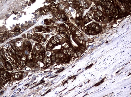 NME1 / NM23 Antibody (clone UMAB94)