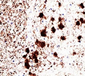 UCHL1 / PGP9.5 Antibody (clone 31A3, Azide-free, BSA-free)