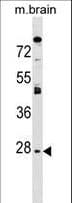 IHC-plus™ AQP1 / Aquaporin 1 Antibody (aa241-269)
