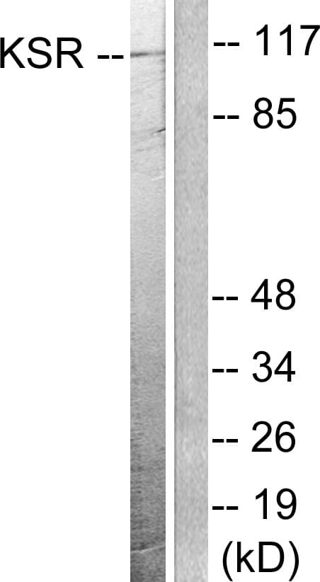 KSR1 Antibody (aa358-407)