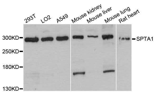 Polyclonal Rabbit anti-Human SPTA1 / Alpha Spectrin Antibody (WB)
