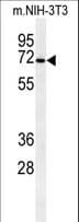 CSGALNACT1 Antibody (aa192-220)