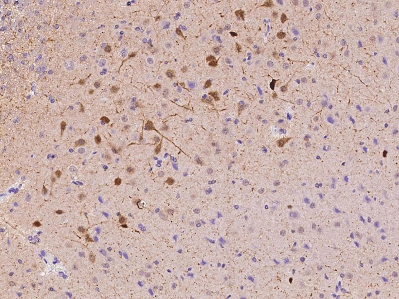 CALB2 / Calretinin Antibody