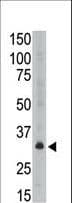 MAGEA6 Antibody (aa214-243)