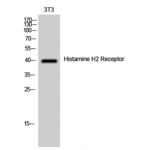 Polyclonal Rabbit anti-Human HRH2 / Histamine H2 Receptor Antibody (100-180 aa, Internal, IF, WB)