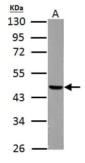 IHC-plus™ FH / Fumarase / MCL Antibody (aa89-365)