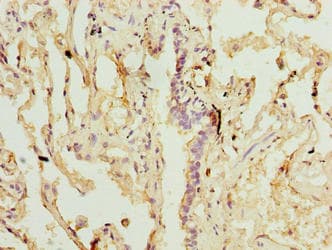 SLA Antibody