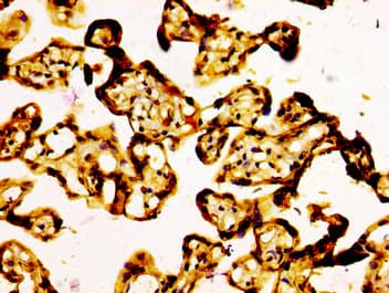ARID1A / BAF250 Antibody