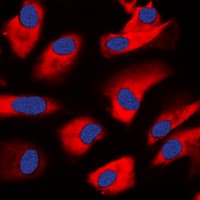 Polyclonal Rabbit anti-Human PRKCZ / PKC-Zeta Antibody (C-Terminus, IHC, IF, WB)
