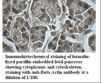 Polyclonal Rabbit anti-Human ACTB / Beta Actin Antibody (IHC, WB)