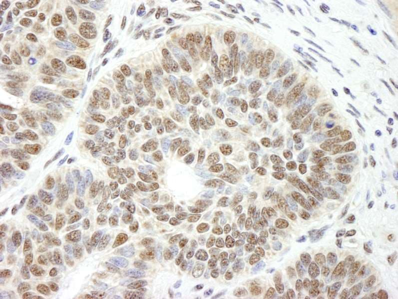 DIS / CCAR1 Antibody (aa1-50)