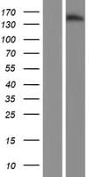 JARID2 / JMJ Protein (Over-Expression Lysate Myc-DDK (Flag))