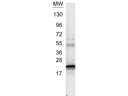 IL6 / Interleukin 6 Antibody