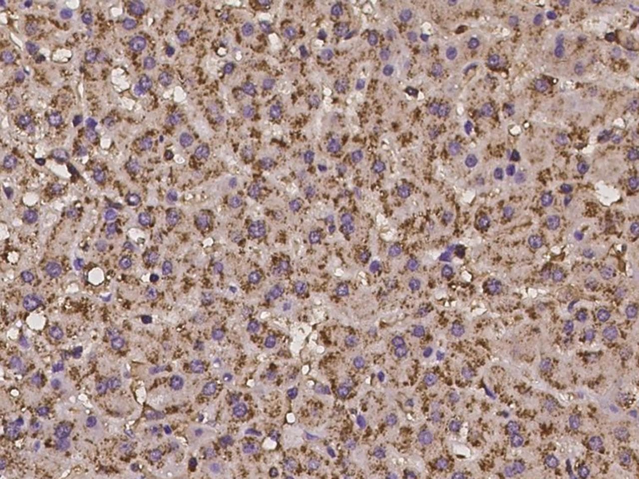 PCDHGB3 Antibody