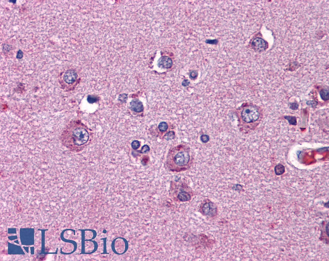 IHC-plus™ Monoclonal Mouse anti-Human NTNG2 / Netrin G2 Antibody (clone 4F11, IHC, WB)