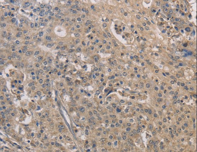 IRAK4 / IRAK-4 Antibody