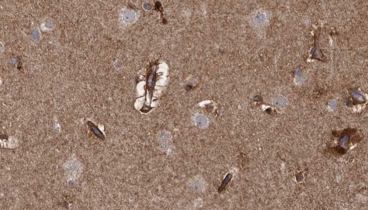Polyclonal Rabbit anti-Human ARHGAP20 Antibody (IHC, WB)