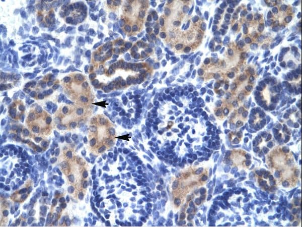 RNF141 Antibody (aa96-145)