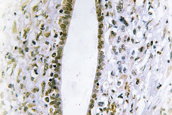 Polyclonal Rabbit anti-Human FES Antibody (Lys161, IHC, WB)