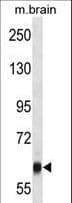 VPS45 Antibody (aa461-489)