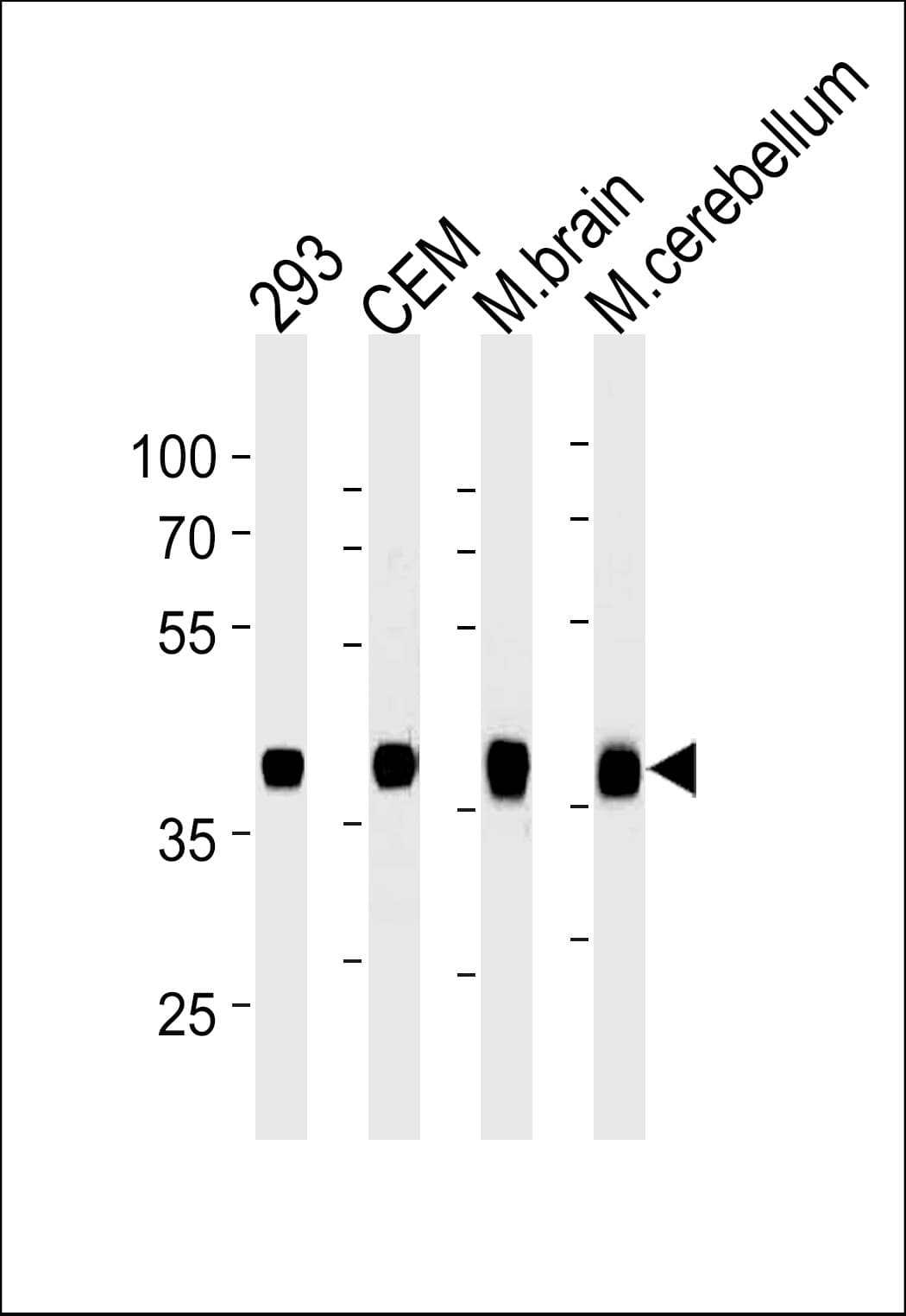 Monoclonal Mouse anti-Human ALDOC / Aldolase C Antibody (clone 859CT9.5.3, IHC, WB)