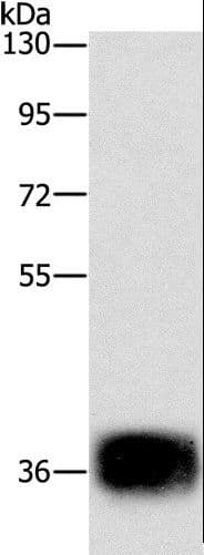 C/EBP Epsilon / CEBPE Antibody
