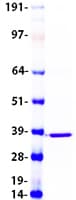 Human DEGS1 Protein (Recombinant Myc-DDK (Flag))