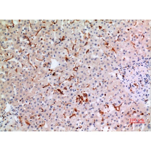 Polyclonal Rabbit anti-Human CYBB / NOX2 / gp91phox Antibody (Internal, IHC, WB)