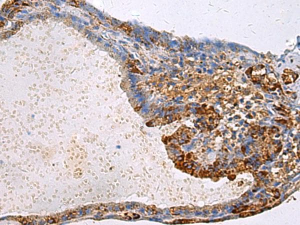 GNAI1 / Gi Antibody