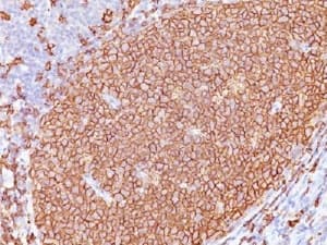 CD20 Antibody (clone L26 + IGEL/733)