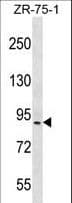 Polyclonal Rabbit anti-Human HRC / HCP Antibody (aa277-306, IHC, WB)