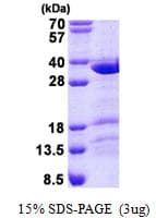 Human CCDC43 Protein (Recombinant His)