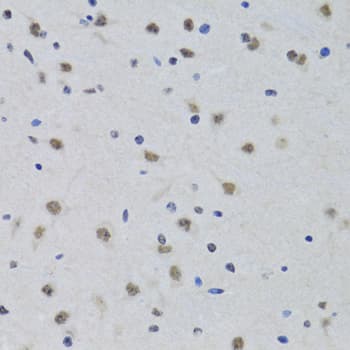 PRPF19 / PRP19 Antibody